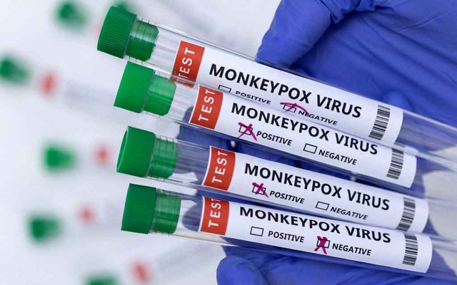 First case of monkeypox confirmed in Ireland